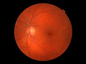 fons-d-ull-salut-visual-optometria-piera-focus